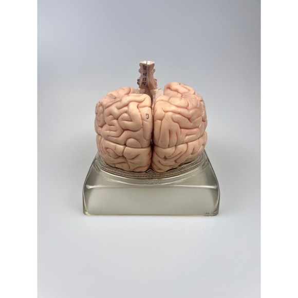 Vintage Somso Germany Anatomical Teaching Model | Human Brain | 6 Parts | Oddity - Picture 3 of 9